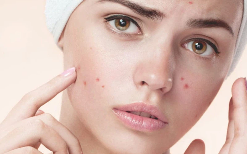 Are facial rollers good for acne