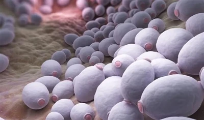 Kan zeep schimmelinfecties veroorzaken?
