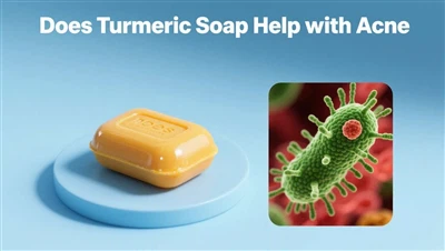 Helpt kurkuma -zeep bij acne? Voordelen, topkeuzes en OEM -gids